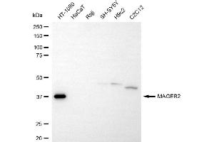 Western blotting analysis using MAGEB2 antibody (ABIN7799358).
