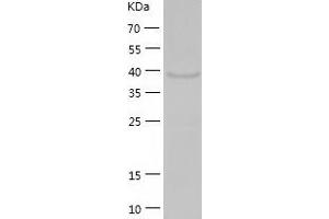 Western Blotting (WB) image for Ethanolamine Kinase 2 (ETNK2) (AA 1-386) protein (His tag) (ABIN7122821) (Ethanolamine Kinase 2 Protein (ETNK2) (AA 1-386) (His tag))