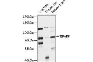 Western blot analysis of extracts of various cell lines, using TIPARP antibody (ABIN7270752) at 1:1000 dilution. (Tiparp 抗体  (AA 1-320))