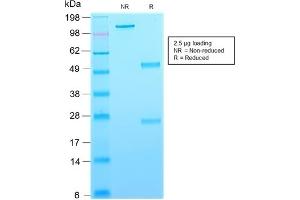 SDS-PAGE Analysis Purified CD63-Monospecific Mouse Recombinant Monoclonal Antibody (rMX-49. (Recombinant CD63 抗体)