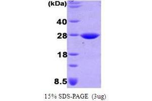 Figure annotation denotes ug of protein loaded and % gel used. (DsbG (AA 18-248) Peptide)