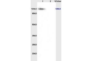 L1 rat thyriod lysates L2 rat brain lysates probed with Anti KIF11/Eg5/TRIP5 Polyclonal Antibody, Unconjugated (ABIN872373) at 1:200 overnight at 4 °C. (K11 (AA 351-450) 抗体)