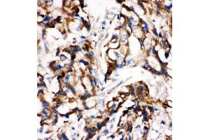 Immunohistochemistry (IHC) image for anti-Mitogen-Activated Protein Kinase Kinase 1 (MAP2K1) (AA 353-367), (C-Term) antibody (ABIN3044391)