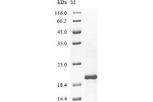 (Tris-Glycine gel) Discontinuous SDS-PAGE (reduced) with 5 % enrichment gel and 15 % separation gel.