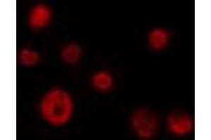 ABIN6274362 staining 293 cells by IF/ICC. (CDK10 抗体  (N-Term))