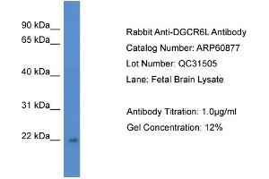 Western Blotting (WB) image for anti-DiGeorge Syndrome Critical Region Gene 6-Like (DGCR6L) (C-Term) antibody (ABIN2788616) (DGCR6L 抗体  (C-Term))