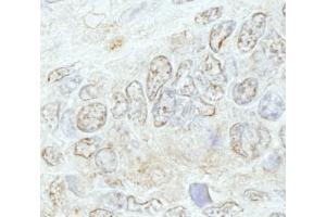 Immunohistochemistry (IHC) image for anti-Methyltransferase Like 3 (METTL3) (AA 1-50) antibody (ABIN7448668)