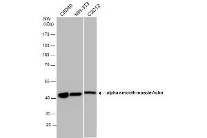Western Blotting (WB) image for anti-Actin, alpha 2, Smooth Muscle, Aorta (ACTA2) (N-Term) antibody (ABIN2857027)
