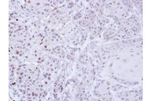 IHC-P Image Immunohistochemical analysis of paraffin-embedded Cal27 Xenograft, using ZNF165, antibody at 1:100 dilution. (ZNF165 抗体)