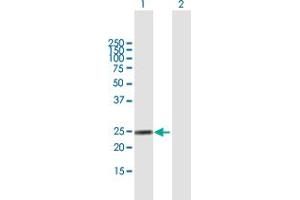 Western Blot analysis of FGA expression in transfected 293T cell line by FGA MaxPab polyclonal antibody. (FGA 抗体  (AA 1-218))