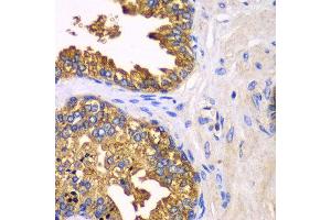 Immunohistochemistry of paraffin-embedded human prostate using SRP19 antibody at dilution of 1:100 (x40 lens). (SRP19 抗体)