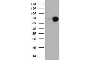 Western Blotting (WB) image for anti-Adenylate Kinase 5 (AK5) antibody (ABIN1496537) (Adenylate Kinase 5 抗体)