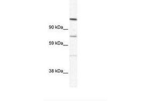Image no. 1 for anti-Ras Association and DIL Domains (Radil) (AA 916-965) antibody (ABIN305634) (Radil 抗体  (AA 916-965))