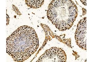 ABIN7095767 and ABIN7099829 at 1/100 staining mouse testis tissue by IHC-P. (RBM25 抗体)