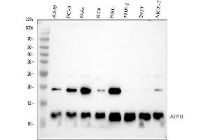 Western blot analysis of NOP10 using anti-NOP10 antibody (ABIN7605737).