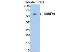 Western Blotting (WB) image for anti-5'-Nucleotidase, Ecto (CD73) (NT5E) (AA 29-550) antibody (ABIN1077721) (CD73 抗体  (AA 29-550))