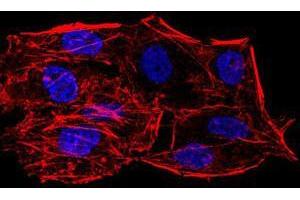 Immunofluorescence analysis of HeLa cells using SIRT6 mouse mAb. (SIRT6 抗体  (AA 141-250))