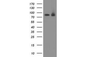Western Blotting (WB) image for anti-Protein Kinase C, epsilon (PRKCE) antibody (ABIN1500231) (PKC epsilon 抗体)