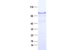 Western Blotting (WB) image for Cortactin (CTTN) protein (DYKDDDDK Tag) (ABIN2712519)