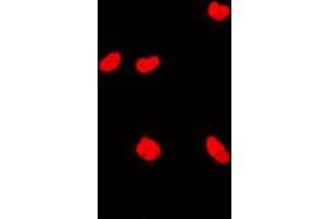Immunofluorescent analysis of KAT7 staining in MCF7 cells. (MYST2 抗体  (Center))