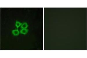 Immunofluorescence analysis of MCF7 cells, using CRHR2 Antibody.