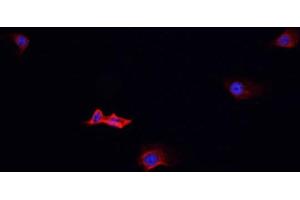 ABIN6268994 staining Jurkat cells by IF/ICC. (PSGR 抗体  (Internal Region))