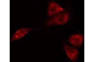 Immunofluorescence (fixed cells) (IF/ICC) image for anti-Solute Carrier Family 30 (Zinc Transporter), Member 4 (SLC30A4) (Internal Region) antibody (ABIN6258421)