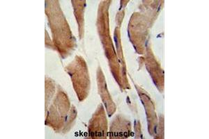 Immunohistochemistry (Paraffin-embedded Sections) (IHC (p)) image for anti-CASP8 and FADD-Like Apoptosis Regulator (CFLAR) (AA 152-182), (Middle Region) antibody (ABIN951489)