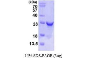 SDS-PAGE (SDS) image for Ribulose-5-Phosphate-3-Epimerase (RPE) (AA 1-228) protein (His tag) (ABIN667693)