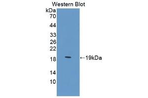 Detection of Recombinant ZBP1, Human using Polyclonal Antibody to Z-DNA Binding Protein 1 (ZBP1) (ZBP1 抗体  (AA 10-167))