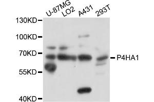 Western blot analysis of extracts of various cell lines, using P4HA1 antibody. (P4HA1 抗体)