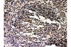 Anti- SIRT7 Picoband antibody, IHC(P) IHC(P): Rat Spleen Tissue (SIRT7 抗体  (AA 8-350))