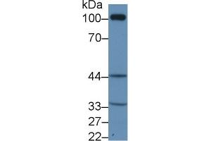 Western Blot; Sample: Rat Kidney lysate; Primary Ab: 1µg/ml Rabbit Anti-Human TP Antibody Second Ab: 0. (TBXA2R 抗体  (AA 3-324))