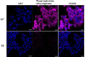 Immunocytochemical staining of HeLa cells using Phosphoglycerate dehydrogenase antibody (ABIN7799808), 1:1,000), Top panel: wild-type (WT), Bottom panal: Phosphoglycerate dehydrogenase shRNA knockdown (KD). (PHGDH 抗体)