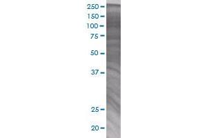 NME6 transfected lysate. (NME6 293T Cell Transient Overexpression Lysate(Denatured))