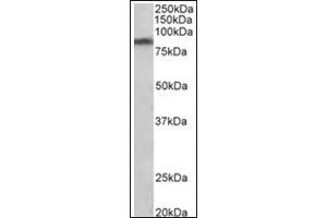 Staining of Human Substantia nigra lysate (35µg protein in RIPA buffer) using SLC6A3 antibody at 1 µg/ml. (SLC6A3 抗体  (Internal Region))