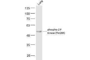 Mouse lung lysates probed with ZIP Kinase (Thr265) Polyclonal Antibody, Unconjugated  at 1:300 dilution and 4˚C overnight incubation. (DAPK3 抗体  (pThr265))