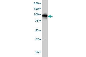 ADAM9 monoclonal antibody (M01), clone 3E6 Western Blot analysis of ADAM9 expression in A-431 . (ADAM9 抗体  (AA 36-135))