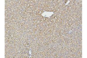IHC analysis of HSPD1 using anti-HSPD1 antibody (ABIN7600976). (HSPD1 抗体  (AA 260-496))