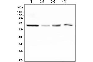 Western blot analysis of PLK1 using anti-PLK1 antibody (ABIN7602573).