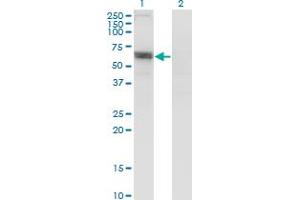 Western Blot analysis of SLC6A16 expression in transfected 293T cell line by SLC6A16 monoclonal antibody (M13), clone 2E5. (SLC6A16 抗体  (AA 406-492))