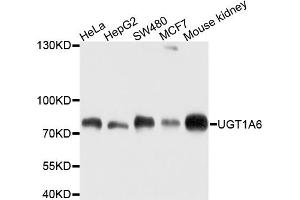 Western blot analysis of extracts of various cell lines, using UGT1A6 antibody (ABIN4905553) at 1:1000 dilution. (UGT1A6 抗体)