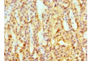 Immunohistochemistry of paraffin-embedded human adrenal gland tissue using ABIN7145594 at dilution of 1:100 (SULT2A1 抗体  (AA 1-145))