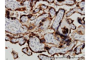 Immunoperoxidase of monoclonal antibody to HSD3B1 on formalin-fixed paraffin-embedded human placenta.