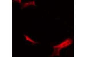 Immunofluorescence (fixed cells) (IF/ICC) image for anti-CD40 (CD40) (C-Term) antibody (ABIN6260623)