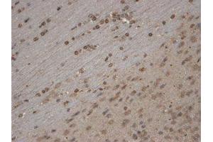 TrpC5 Immunohistochemistry.