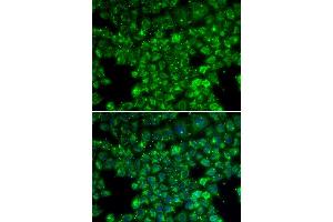 Immunofluorescence analysis of U20S cell using LYZL6 antibody. (LYZL6 抗体)