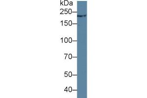 Detection of TCHH in Rat Skin lysate using Polyclonal Antibody to Trichohyalin (TCHH) (Trichohyalin 抗体  (AA 1851-1943))