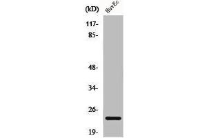 Western Blot analysis of HuvEc cells using Caveolin-1 Polyclonal Antibody (Caveolin-1 抗体  (C-Term))
