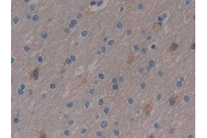Detection of ENO3 in Human Brain Tissue using Polyclonal Antibody to Enolase 3 (ENO3) (ENO3 抗体  (AA 1-391))